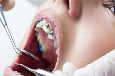 How A Professional Orthodontist And Dentist In Waco Can Improve Your Oral Health