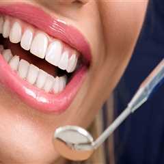 How To Find The Right Dental Care Facility For Premium Teeth Whitening In Basel