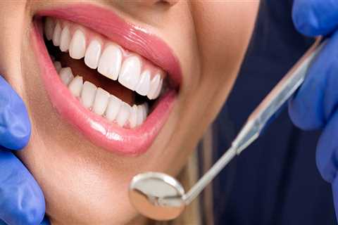 How To Find The Right Dental Care Facility For Premium Teeth Whitening In Basel