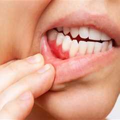 Basel Periodontics: How Dental Care Services Address Gum Disease