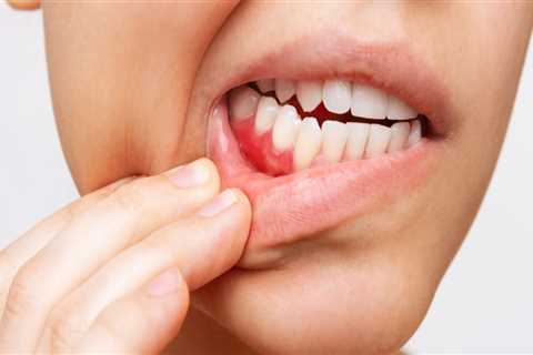 Basel Periodontics: How Dental Care Services Address Gum Disease