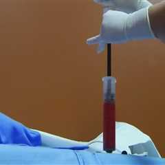 Why Medical Professional Networking Matters For Stem Cell Transplantation Success In Lake Worth, FL