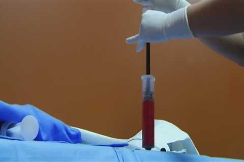 Why Medical Professional Networking Matters For Stem Cell Transplantation Success In Lake Worth, FL